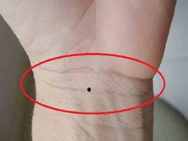 Nốt ruồi ở cổ tay có ý nghĩa gì trong vận mệnh? Hung hay cát?