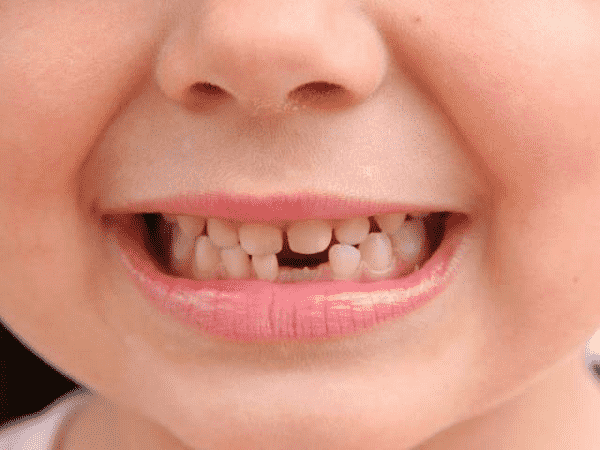 Nằm mơ thấy rụng răng đánh con gì?