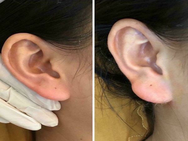 Xem tướng tai phật đoán vận mệnh tốt xấu ở con người