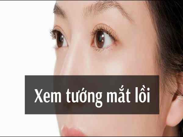 Tướng phụ nữ mắt lồi