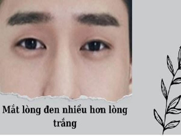 Đặc điểm mắt tròng đen nhiều hơn tròng trắng