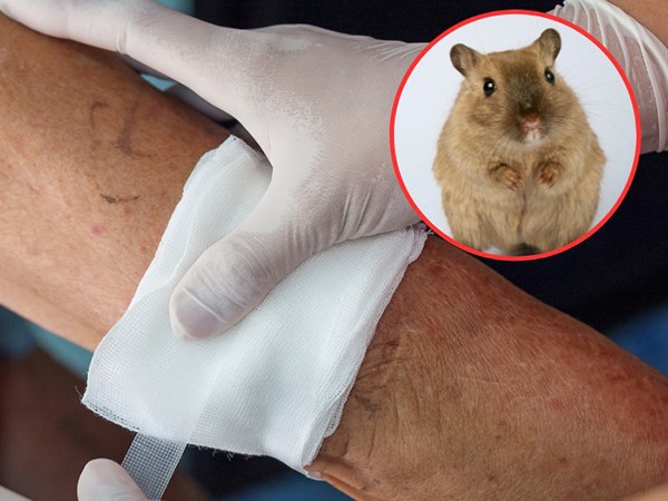 Nằm mơ thấy chuột cắn chân là điềm gì, số mấy con gì?